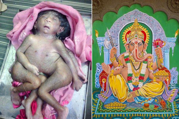baby-with-four-legs-four2