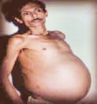 Sanjay