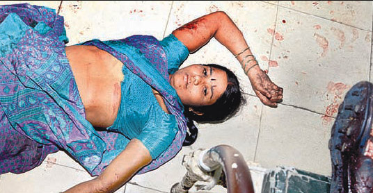 osmania hospital bomb blast victims  treatment 