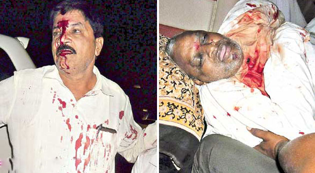 tdp seniorl leader yerram naidu dies in road accident