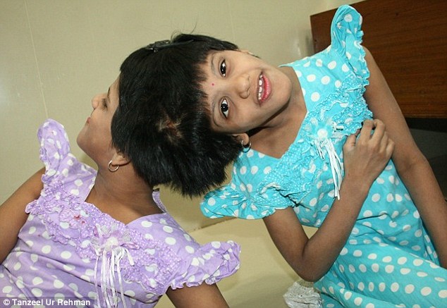 Children's Hospital, the lives of Veena and Vani