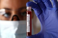 75 new coronavirus cases reported in telangana tally rises to 229