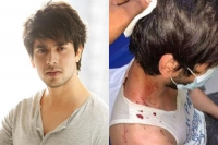 Tv actor ansh bagri badly beaten up by 10 men in delhi