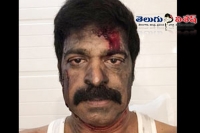 Actor brahmaji diwali wishes with wounded face pic
