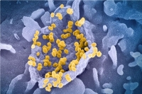Lambda lineage of sars cov 2 has potential to become variant of concern