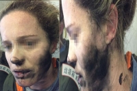 Plane passenger suffers burns as headphones catch fire on flight from beijing to melbourne