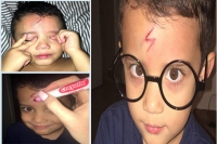 Mom brilliantly turns son s forehead cut into the harry potter scar