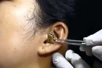 Viral video snake gets trapped in woman s ear hole doctor tries to pull out the reptile
