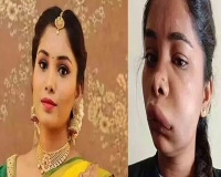 Kannada actress swathi sathish s root canal surgery goes horribly wrong
