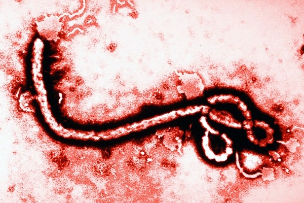 First ebola death recorded in america