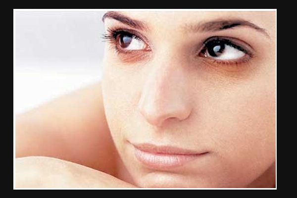 Home remedies for dark circles under eyes