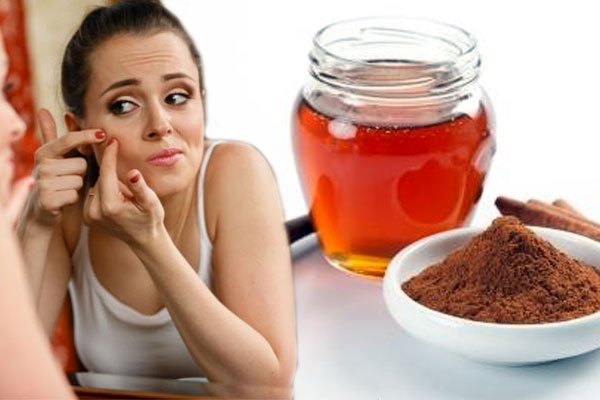 Beauty tips pimple black spots smooth skin